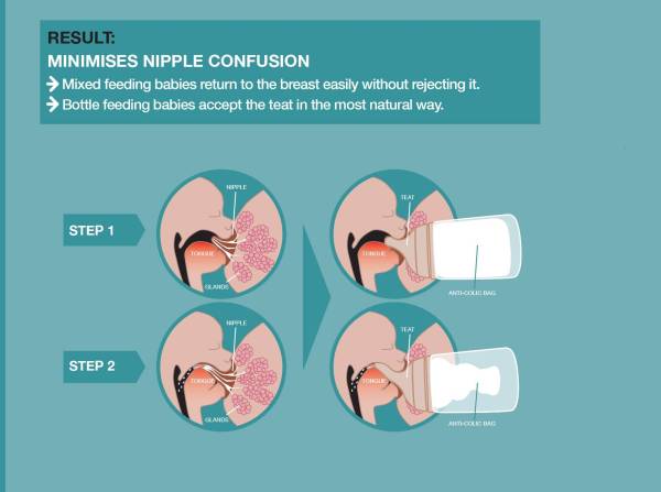SUAVINEX Zero.Zero Anticolic Bottle Set 180ml - Fair Skin